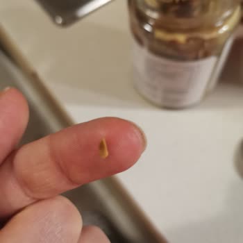 Antebella Fıstık Kremasında Kabuğu Çıkan Parça Çocuğumun Dişine Sıkıştı