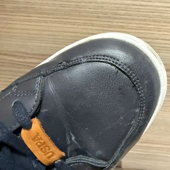 Ayakkabının Dikiş Hattında Deri Soyulması Ve İade Talebinin Reddedilmesi