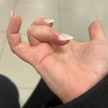Pendik Hair & Nail Protez Tırnak Sonrası Parmağım Dolama Oldu
