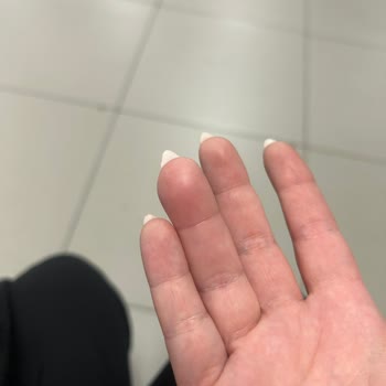 Pendik Hair & Nail Protez Tırnak Sonrası Parmağım Dolama Oldu