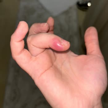 Pendik Hair & Nail Protez Tırnak Sonrası Parmağım Dolama Oldu