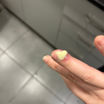 Pendik Hair & Nail Protez Tırnak Sonrası Parmağım Dolama Oldu