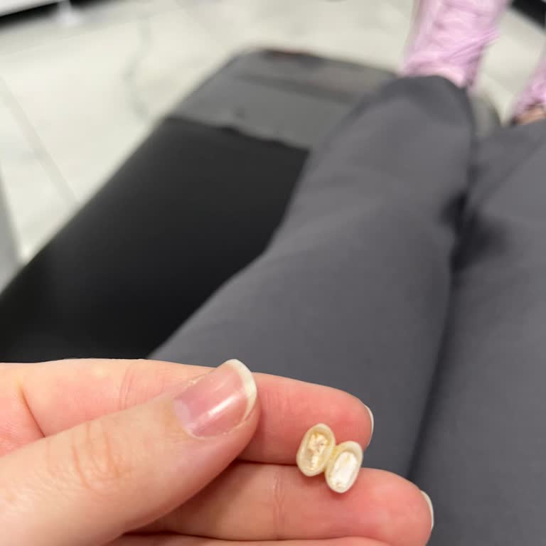 Medilife Beylikdüzü Şubesinde Kırılan Diş Kaplaması Ve 20 Bin TL İade Talebi