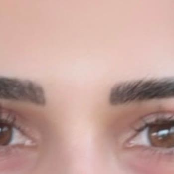 Eda Güneş Makeup Stüdyo Yaşadığım Acı, İşlem Sırasındaki Tutum Ve Ortaya Çıkan Sonuç Kötü