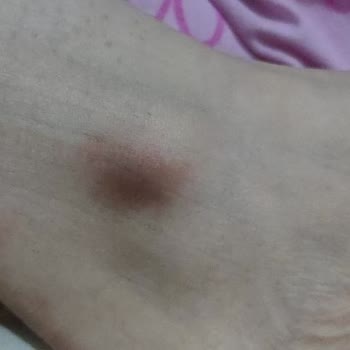 Glow İn Dermis Güzellik Hizmetleri Mesajlara Ve Aramalarıma Kesinlikle Dönüş Yapılmıyor