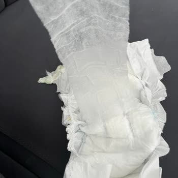 Molfix Bezlerinde Jelimsi Kirlenme Ürün Değişimi Talebi