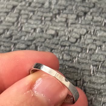 Yüzüğüm Aynı Yerden Kırıldı, Servis Süreci Uzun Ve Belirsiz