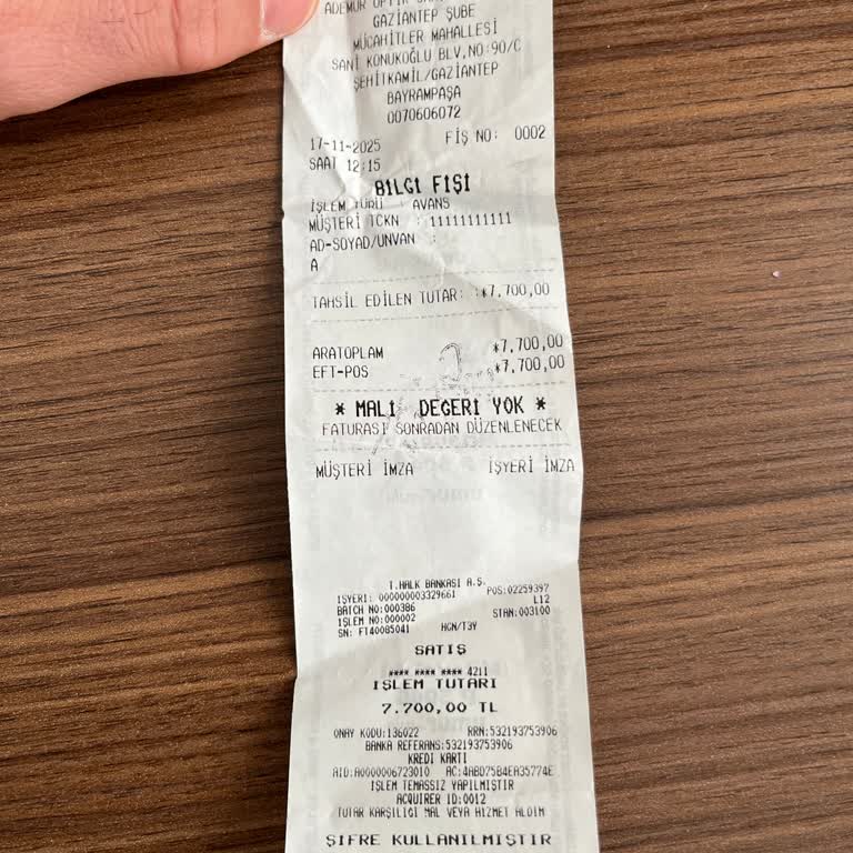 Rayban Gözlüğümde Burun Darlığı Nedeniyle Ağrı Ve Konforsuzluk