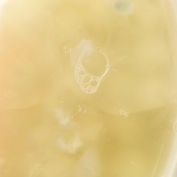 Ekici Top Peynirde Küf Sorunu Sağlık Ve Güveni Sarsıyor