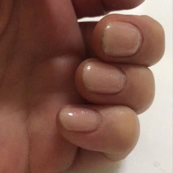 Kalıcı Oje Dayanmaz, Tırnaklar Çabuk Kırılıyor Ve Personel Kaba