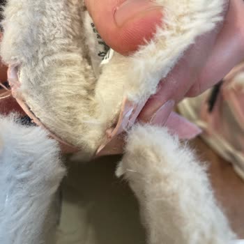 Çocuk Botunda Bilek Yarası Ve Şiddetli Ayak Ağrısı