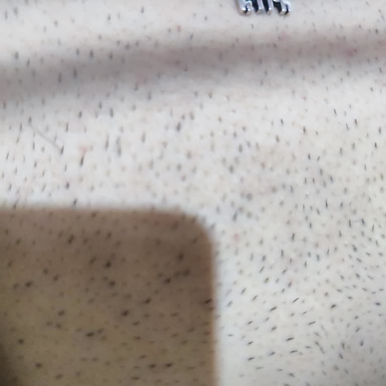 Epify Tüy Dökücü Kremin 3 Ay Kıl Çıkarmaz Sözünün Gerçekleşmemesi