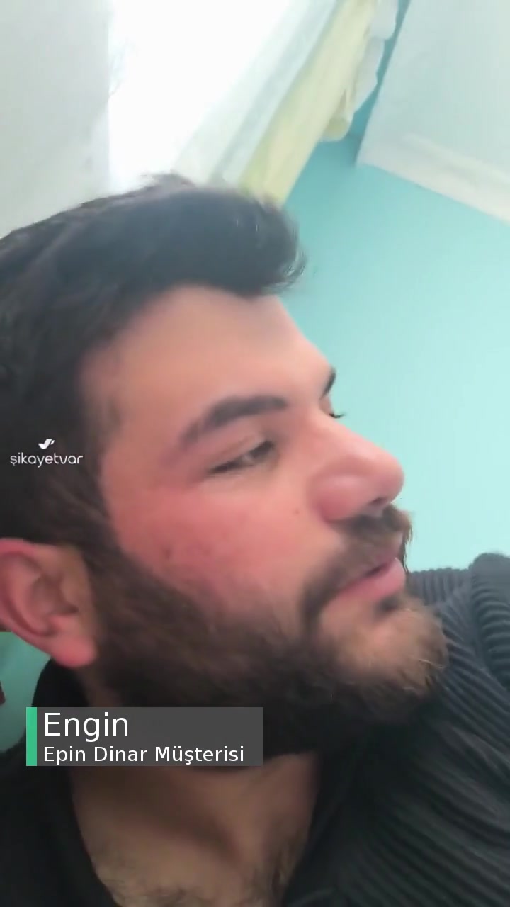 Epin Dinar UC Aldım Hesaba Gelmedi! videonun kapak resmi