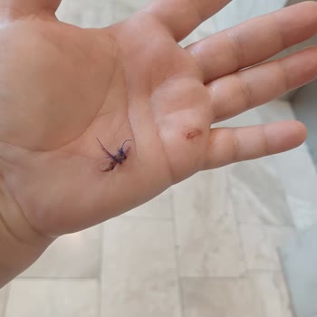 Paslı Vida Nedeniyle Kaydıraktan Düşen Misafirin Yaralanması Ve Tesisin Duyarsız Tutumu