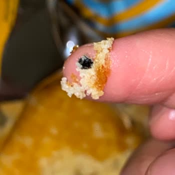 Torku Sade Kekte Yabancı Cisim Tespiti Ve Sağlık Endişesi