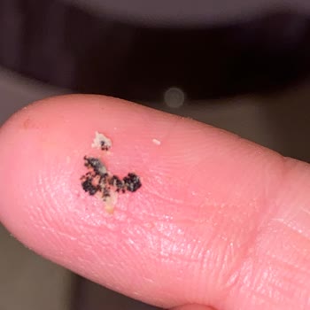 Torku Sade Kekte Yabancı Cisim Tespiti Ve Sağlık Endişesi