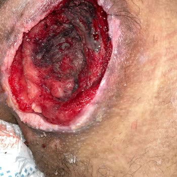 Yüzde 96 Engelli Yatalak Oğlumun İnsanlık Dışı Koşullarda Tutulması