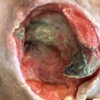 Yüzde 96 Engelli Yatalak Oğlumun İnsanlık Dışı Koşullarda Tutulması