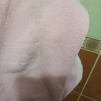 Bosch Çamaşır Makinesinde Leke Çıkarma Sorunu, Beyazların Sararması Ve Yetersiz Servis