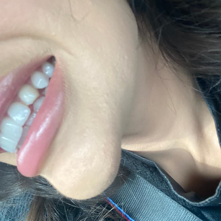 Dr. Rıfat Yıldız Kliniği Tedaviden Memnun Kalmadım!