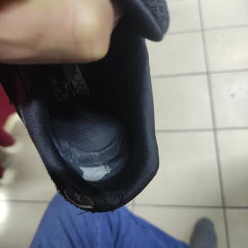 Skechers Ayakkabım Kısa Sürede Aşırı Yıprandı, Kullanıcı Hatası Dendi Ve Çözüm Sunulmadı