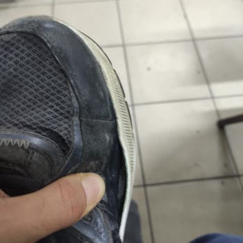 Skechers Ayakkabım Kısa Sürede Aşırı Yıprandı, Kullanıcı Hatası Dendi Ve Çözüm Sunulmadı