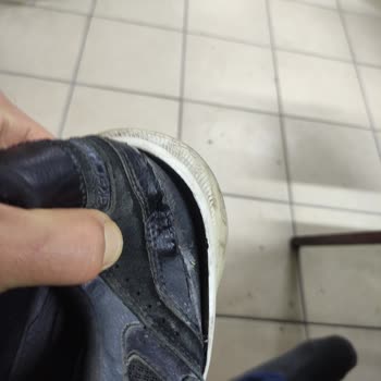 Skechers Ayakkabım Kısa Sürede Aşırı Yıprandı, Kullanıcı Hatası Dendi Ve Çözüm Sunulmadı