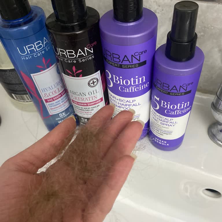 Urban Care Şampuanı Kullanımı Sonrası Şiddetli Saç Dökülmesi Ve Kaşıntı Şikayeti