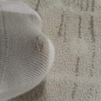 Sağ Ayağındaki Reebok Spor Ayakkabısı Çorap Yırtıyor, Garanti Red Kararı