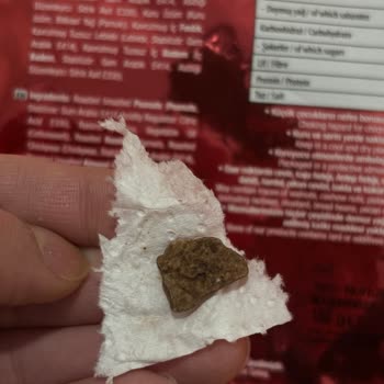 Kavrulmuş Karışık Kuruyemiş İçinde Büyük Taş: Sağlık Riski