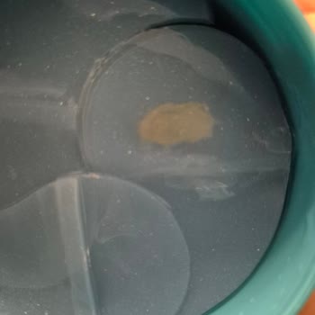 Isana Göz Pedlerinde Mikrobiyal Bozulma Ve Sağlık Riski