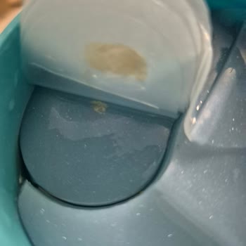 Isana Göz Pedlerinde Mikrobiyal Bozulma Ve Sağlık Riski