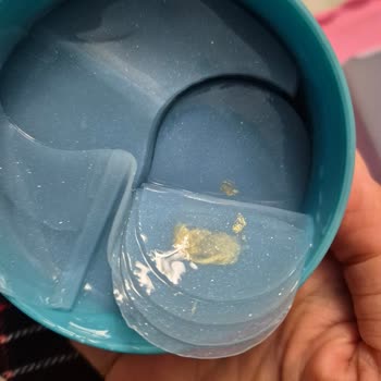 Isana Göz Pedlerinde Mikrobiyal Bozulma Ve Sağlık Riski