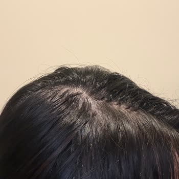 Imperial Hair Extensions Takılan Saçı Ne Yumuşatabiliyorum Ne De Düzgünce Şekillendirebiliyorum