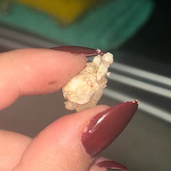 Şampiyon Kokoreç'te Kıl Bulunması: Hijyen Şikayeti Ve İade