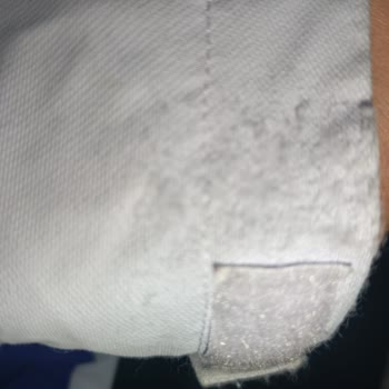 Columbia Montunda Cırtı Bölgesinde Aşırı Tüylenme Ve Ürün Değişim Talebi