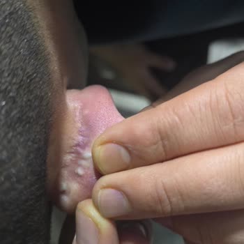 Medical Park Hastanesi’nde Kulak Ameliyatı Sonrası Şişlik Ve Ağrı Nedeniyle Malpraktis İddiası