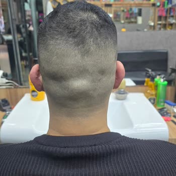 Medical Park Hastanesi’nde Kulak Ameliyatı Sonrası Şişlik Ve Ağrı Nedeniyle Malpraktis İddiası