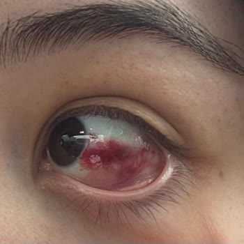 Medipol Sağlık Grubu Pendik Bebek Yaralanması ve Bilgilendirme Eksikliği