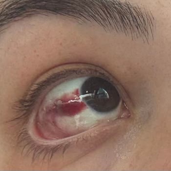 Medipol Sağlık Grubu Pendik Bebek Yaralanması ve Bilgilendirme Eksikliği