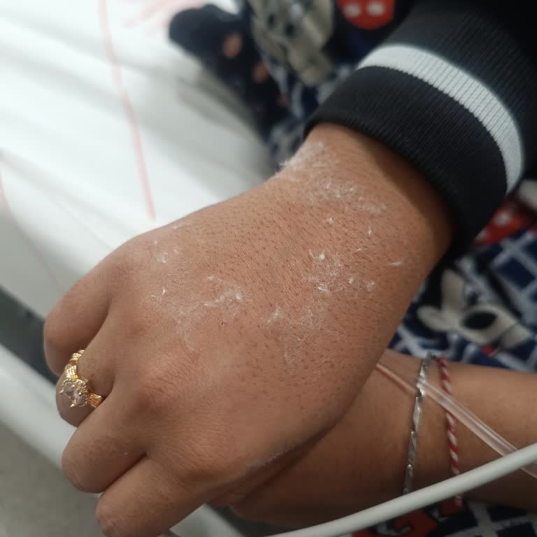 Yoğun Bakımda Hemşirenin Sert Ve Acı Verici Davranışı