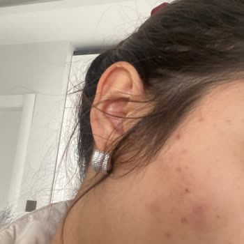 Kars Deluxe Vip Güzellik Merkezinde Zararlı Cilt Bakımı Ve Ücret İptali