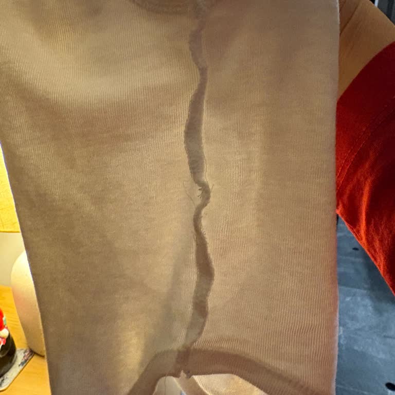 Prima Bebek Bezlerinde Sürekli Sızdırma Sorunu Ve Telafi Talebi