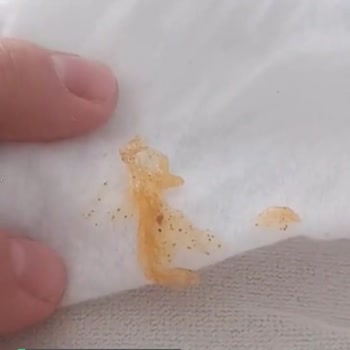 Berona Noodle İçinden Çıkan Madde