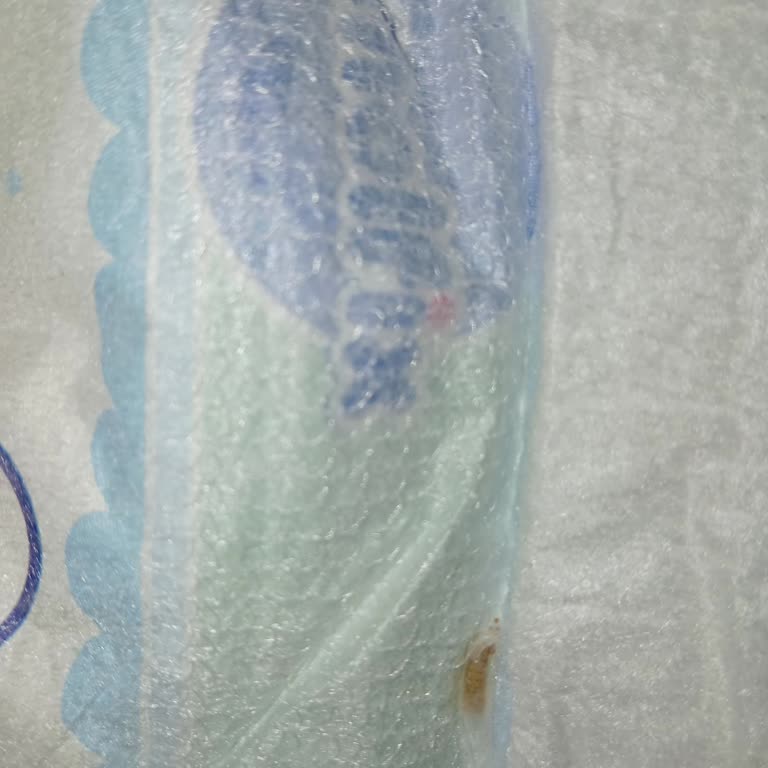 Molfix Bebek Bezinde Kurtlar Bulundu