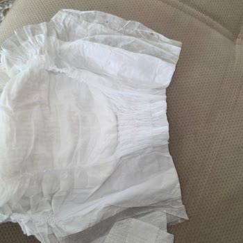 Molfix Bebek Bezinde Bant Eksikliği Nedeniyle Kullanılamaz Ürün Şikayeti