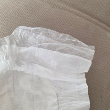 Molfix Bebek Bezinde Bant Eksikliği Nedeniyle Kullanılamaz Ürün Şikayeti