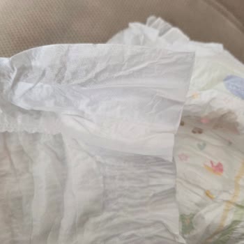 Molfix Bebek Bezinde Bant Eksikliği Nedeniyle Kullanılamaz Ürün Şikayeti