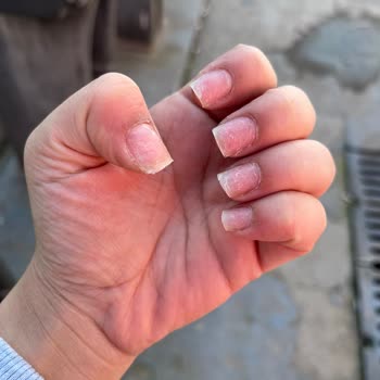 Güzellik merkezinde hizmet ve ödeme şikayeti