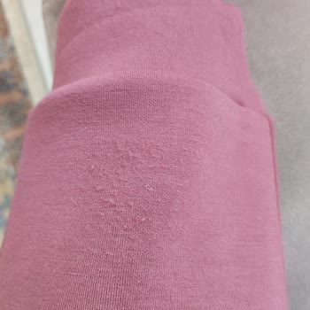 Kısa Sürede Tüylenen Eşofman Ve Destek Eksikliği